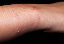 Too Big For One’s Boots