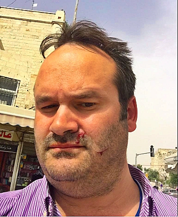 Seth Frantzman, oped editor and features writer at the Jerusalem Post, was hit in the face at a Jerusalem peaceful coexistence event by "anti-normalization" Arabs. 