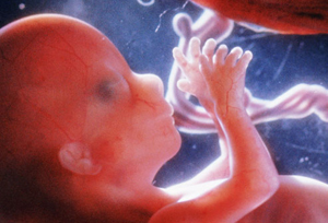 Tendler-110212-Fetus
