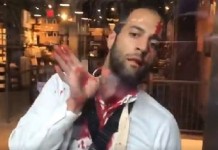 In NYC: Jewish Man Bloodied by Pro-Palestinian ‘Protesters’