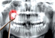 By The Skin Of His Teeth